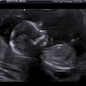 Babylist Registry Photo.