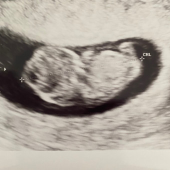Babylist Registry Photo.