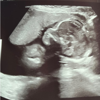 Babylist Registry Photo.