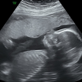 Babylist Registry Photo.