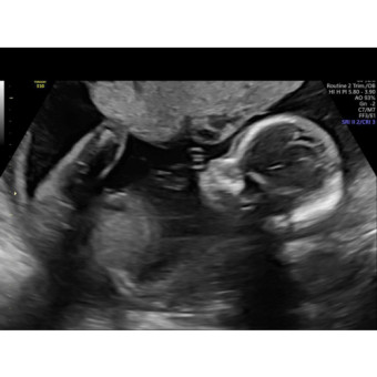 Babylist Registry Photo.