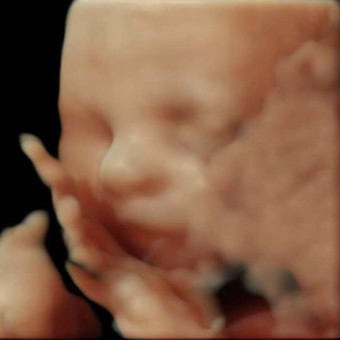 Babylist Registry Photo.