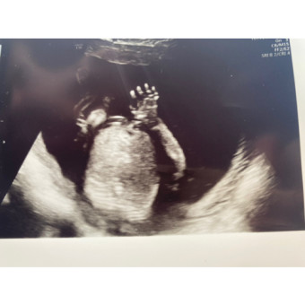 Babylist Registry Photo.