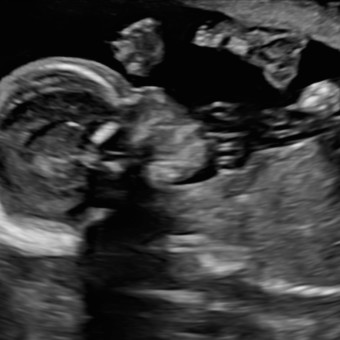 Babylist Registry Photo.
