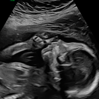 Babylist Registry Photo.