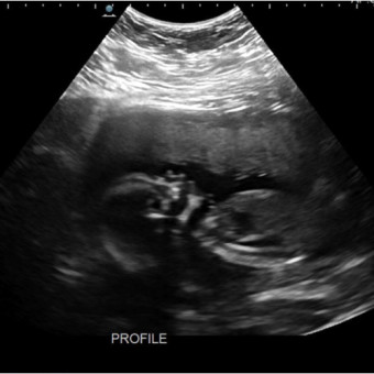 Babylist Registry Photo.
