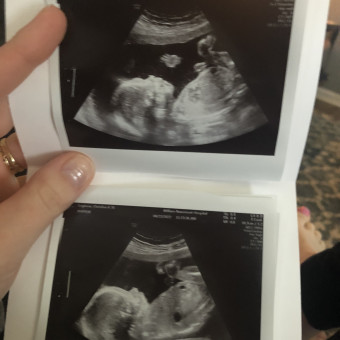 Babylist Registry Photo.