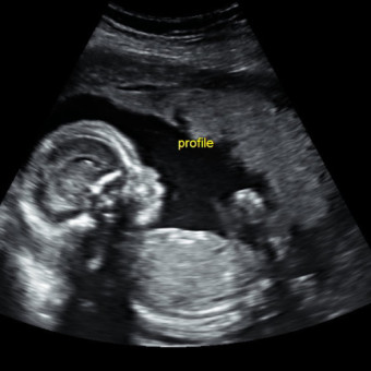 Babylist Registry Photo.