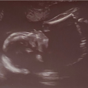 Babylist Registry Photo.