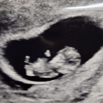 Babylist Registry Photo.