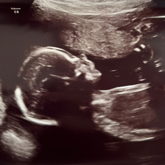 Babylist Registry Photo.