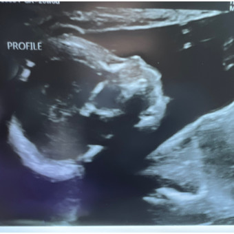 Babylist Registry Photo.