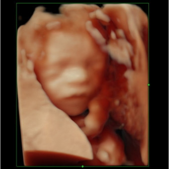 Babylist Registry Photo.