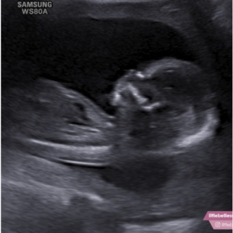 Babylist Registry Photo.