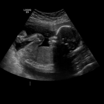 Babylist Registry Photo.