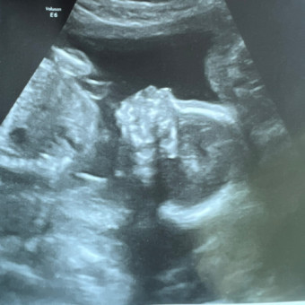 Babylist Registry Photo.
