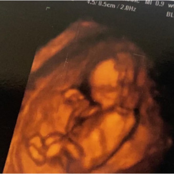 Babylist Registry Photo.