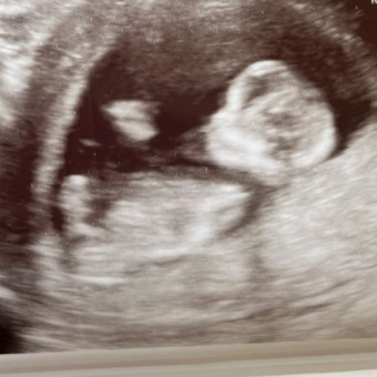 Babylist Registry Photo.
