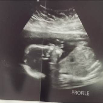 Babylist Registry Photo.