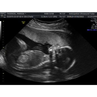 Babylist Registry Photo.