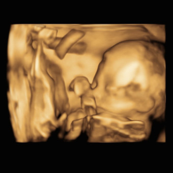 Babylist Registry Photo.