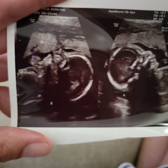 Babylist Registry Photo.