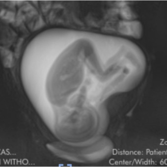 Babylist Registry Photo.