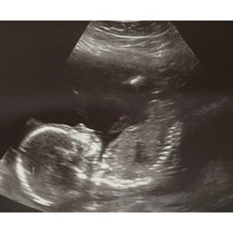 Babylist Registry Photo.