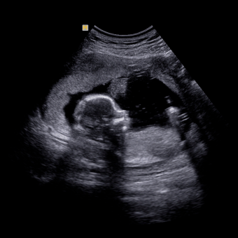 Babylist Registry Photo.