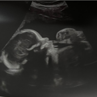 Babylist Registry Photo.