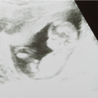 Babylist Registry Photo.