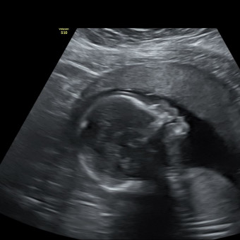 Babylist Registry Photo.