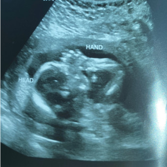 Babylist Registry Photo.
