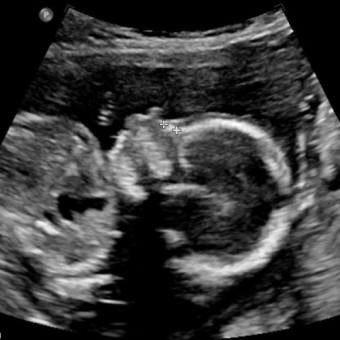 Babylist Registry Photo.