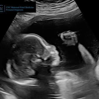 Babylist Registry Photo.