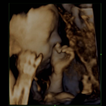Babylist Registry Photo.