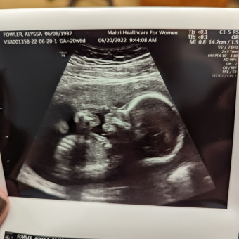 Alyssa + John's Baby Registry Photo.