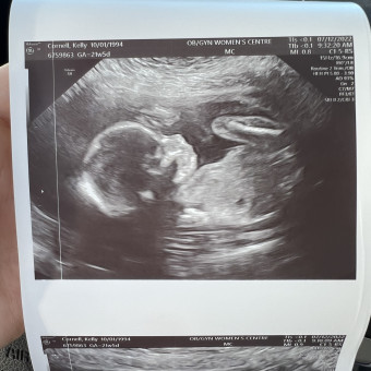 Babylist Registry Photo.