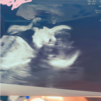Babylist Registry Photo.