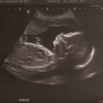 Babylist Registry Photo.