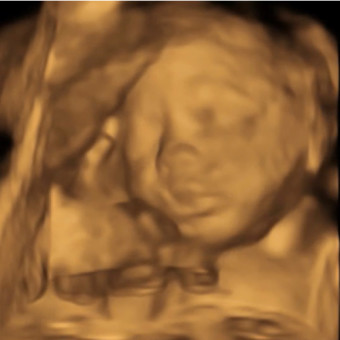 Babylist Registry Photo.
