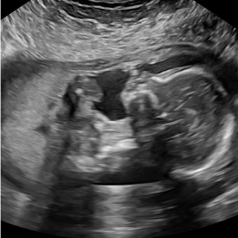 Babylist Registry Photo.