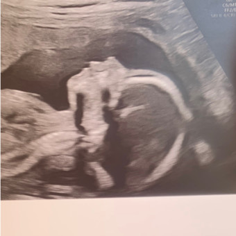 Babylist Registry Photo.