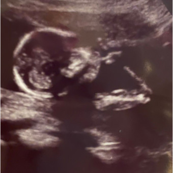 Babylist Registry Photo.