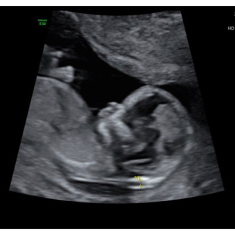 Babylist Registry Photo.