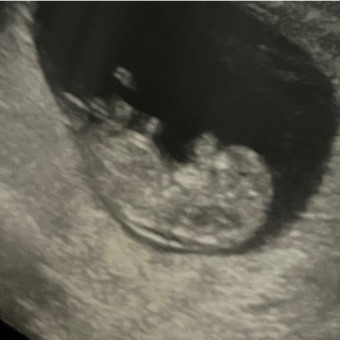 Babylist Registry Photo.