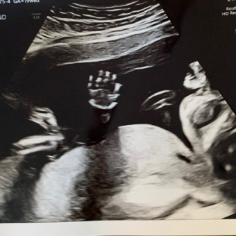 Babylist Registry Photo.