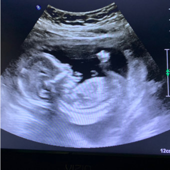 Babylist Registry Photo.