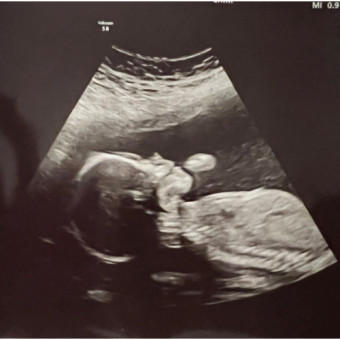 Babylist Registry Photo.