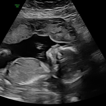 Babylist Registry Photo.